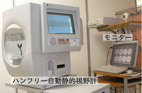 静的視野検査