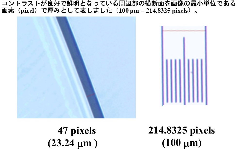 2週間装用SCLのOA(-3 D)における位相差顕微鏡所見による周辺部厚測定(画像解析ソフト)
